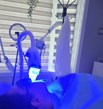 Teeth whitening session in progress under the blue light at Aura Aesthetics